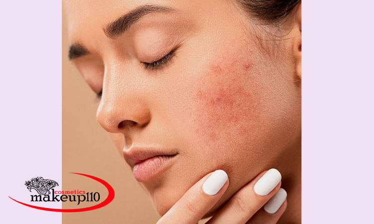 اشتباهات رایج در روتین پوستی