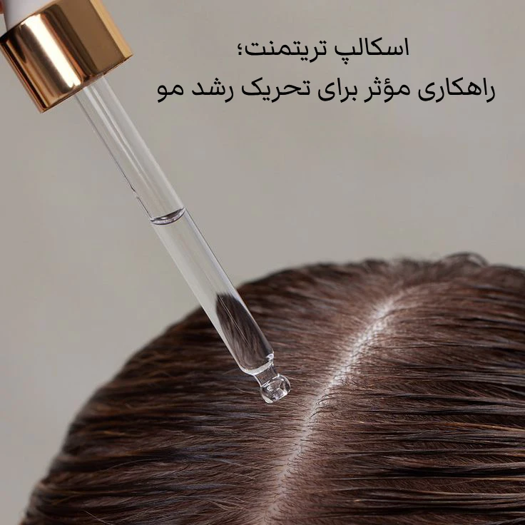 اسکالپ تریتمنت